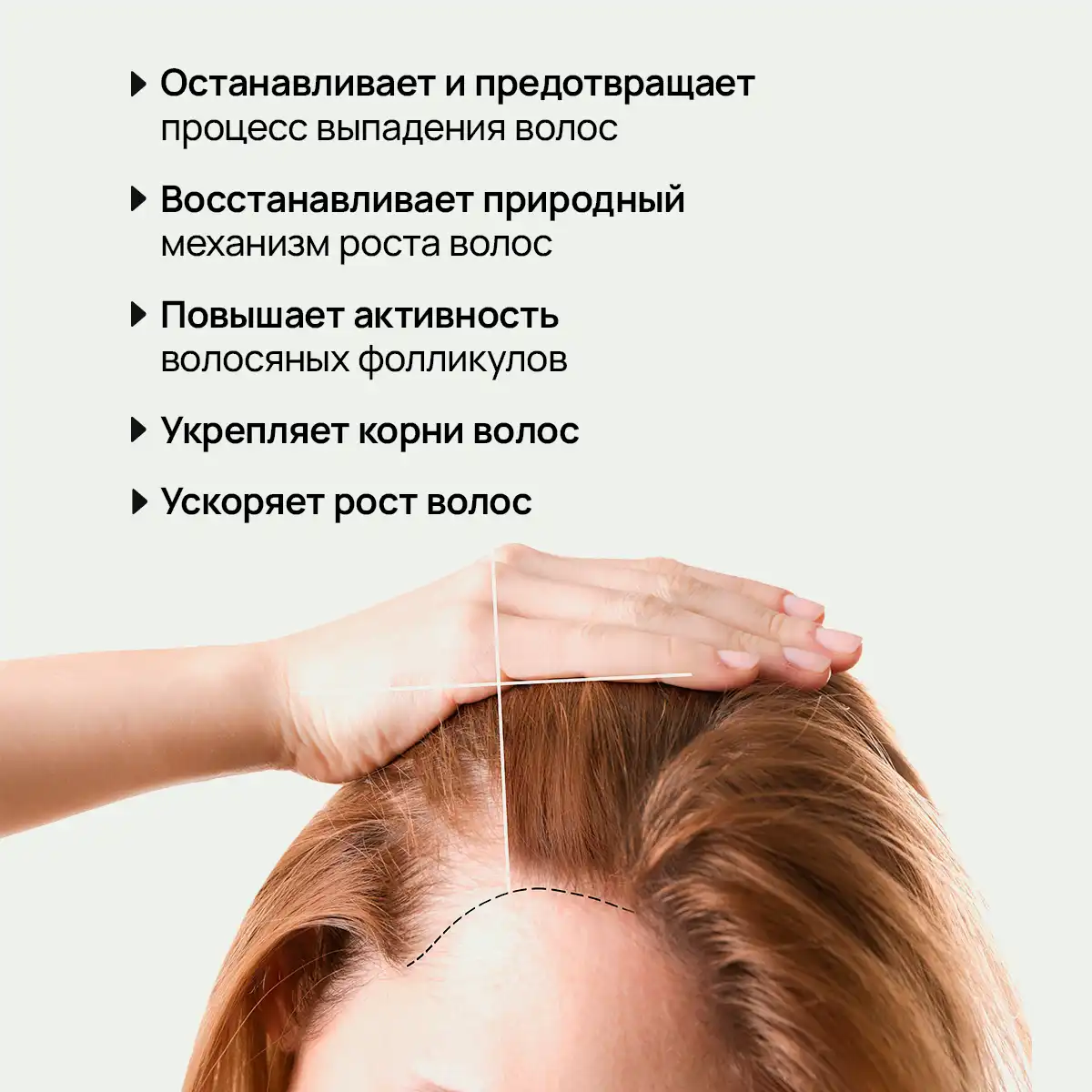 Крем-бальзам от облысения, 500 г