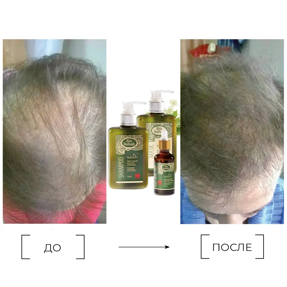 Șampon-activator de creștere a părului, 250 g