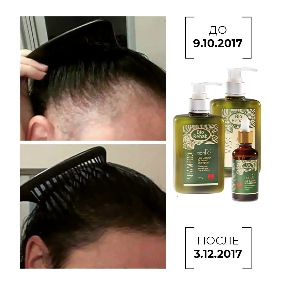 Șampon-activator de creștere a părului, 250 g